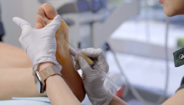 Non-surgical Treatment 